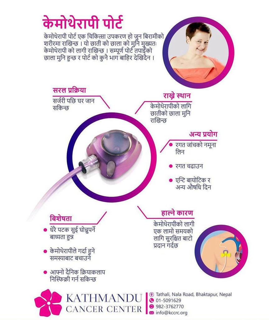 Chemotherapy Treatment in KCC Bhaktapur Nepal