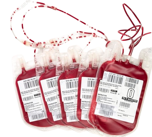 Blood cancer treatment at KCC Nepal