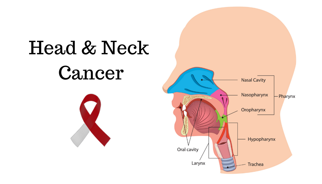 Head and neck cancer treatment at KCC Nepal
