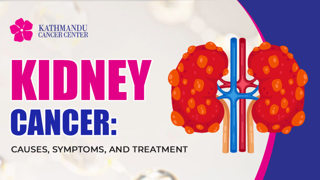 Kidney Cancer